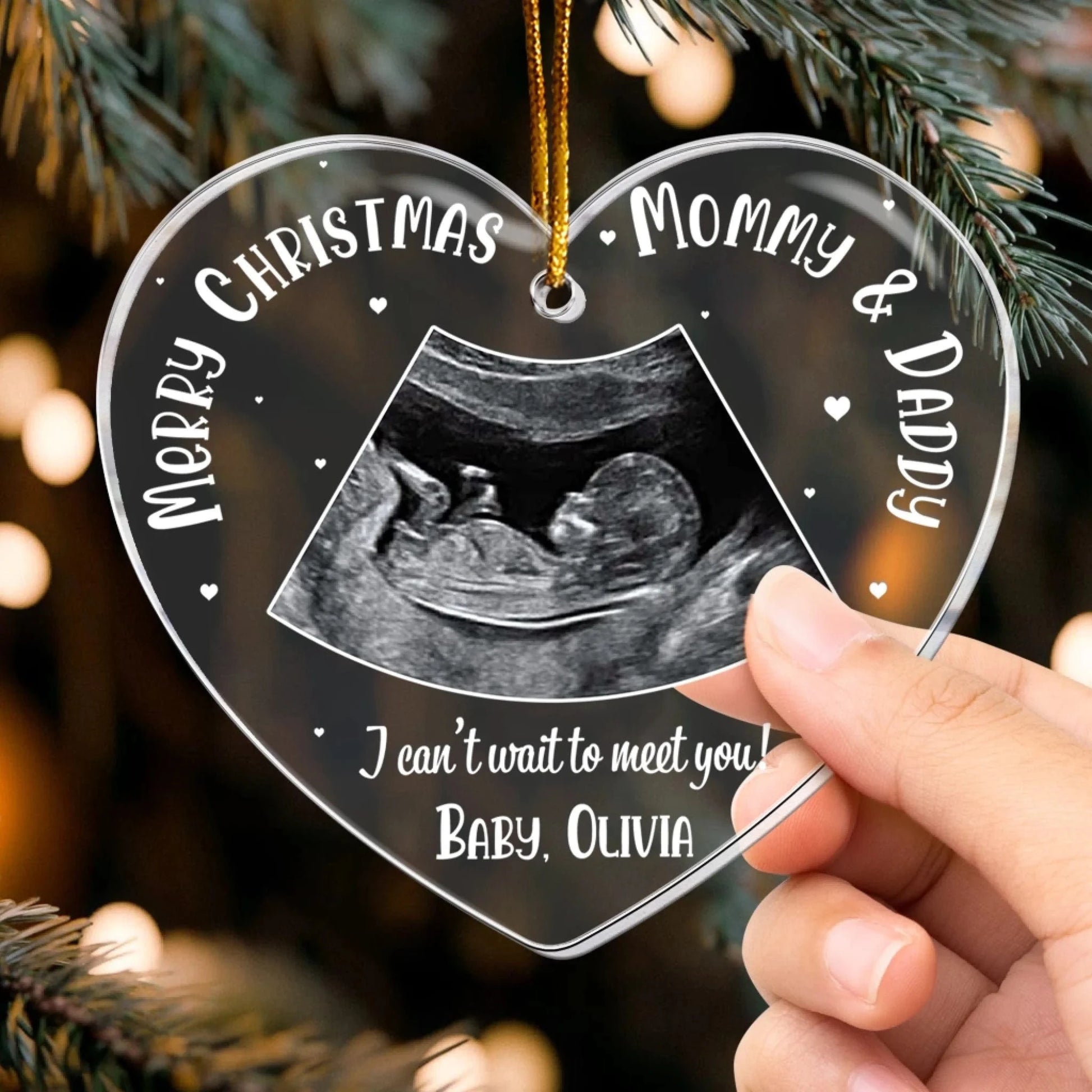 Christmas Coming Baby Bump - Personalized Ultrasound Acrylic Photo Ornament