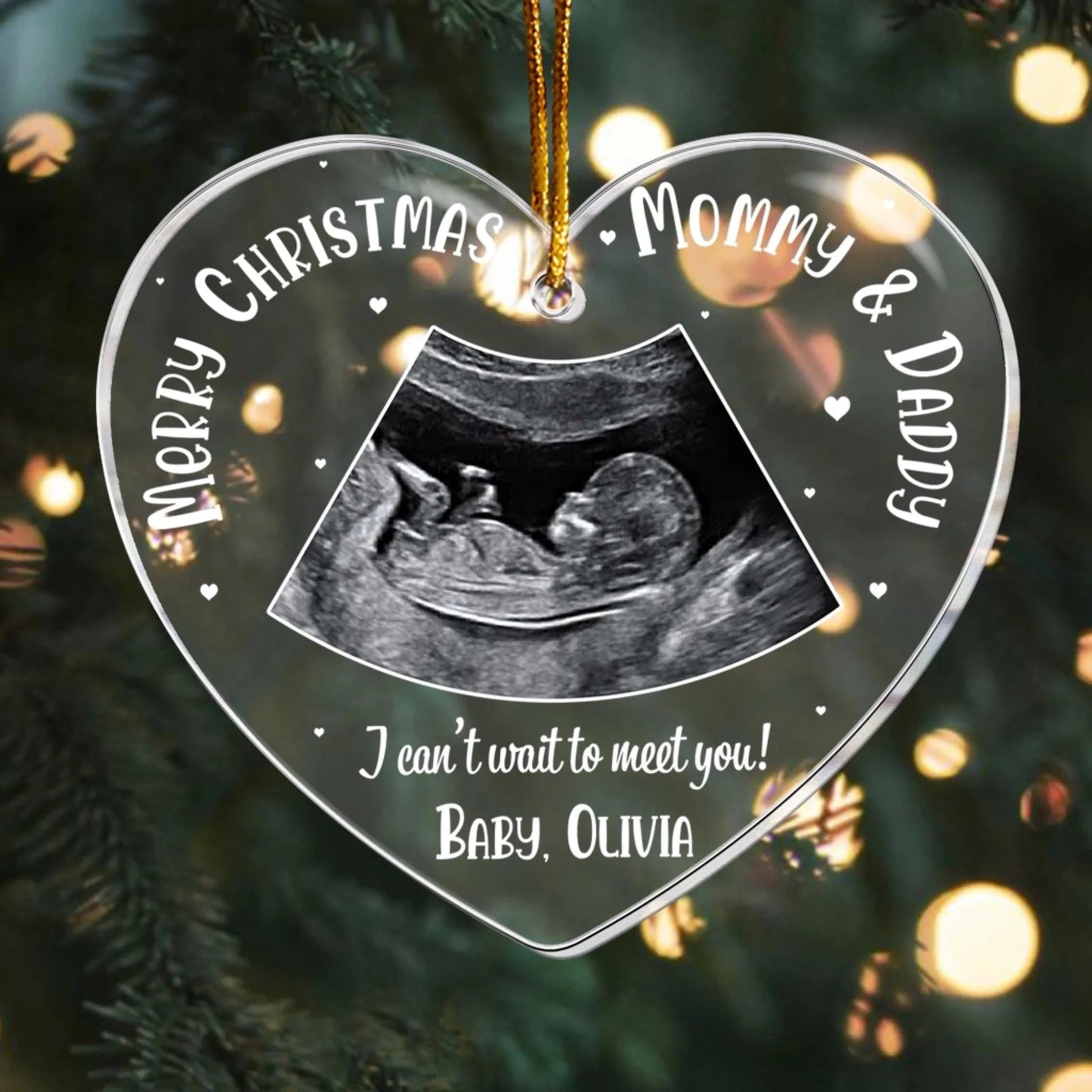 Christmas Coming Baby Bump - Personalized Ultrasound Acrylic Photo Ornament